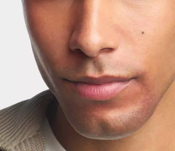 Close-up van de gezichtshuid met milde roodheid en textuurvariaties die geassocieerd worden met rosacea-gevoelige huid