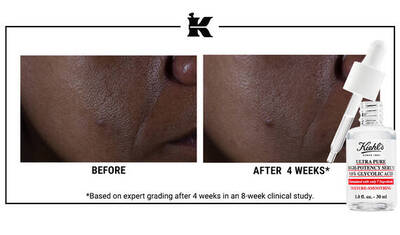 Before and after images showing skin improvement over four weeks, with visible changes in texture and clarity. A dropper bottle of Kiehl's Ultra Pure Glycolic Acid Serum is featured below the images.