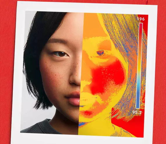 Een split-screen portret van een vrouw die haar natuurlijke gezicht toont links en een thermische warmtekaart van haar huid rechts, die temperatuur- of gevoeligheidsniveaus aangeeft.