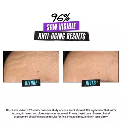 Two images side by side showing skin before and after an anti-aging treatment. The left shows skin with visible wrinkles and uneven texture, labeled "Before." The right displays smoother, firmer skin with fewer wrinkles, labeled "After." A statistic states that 96% of participants noticed visible anti-aging results during a study.