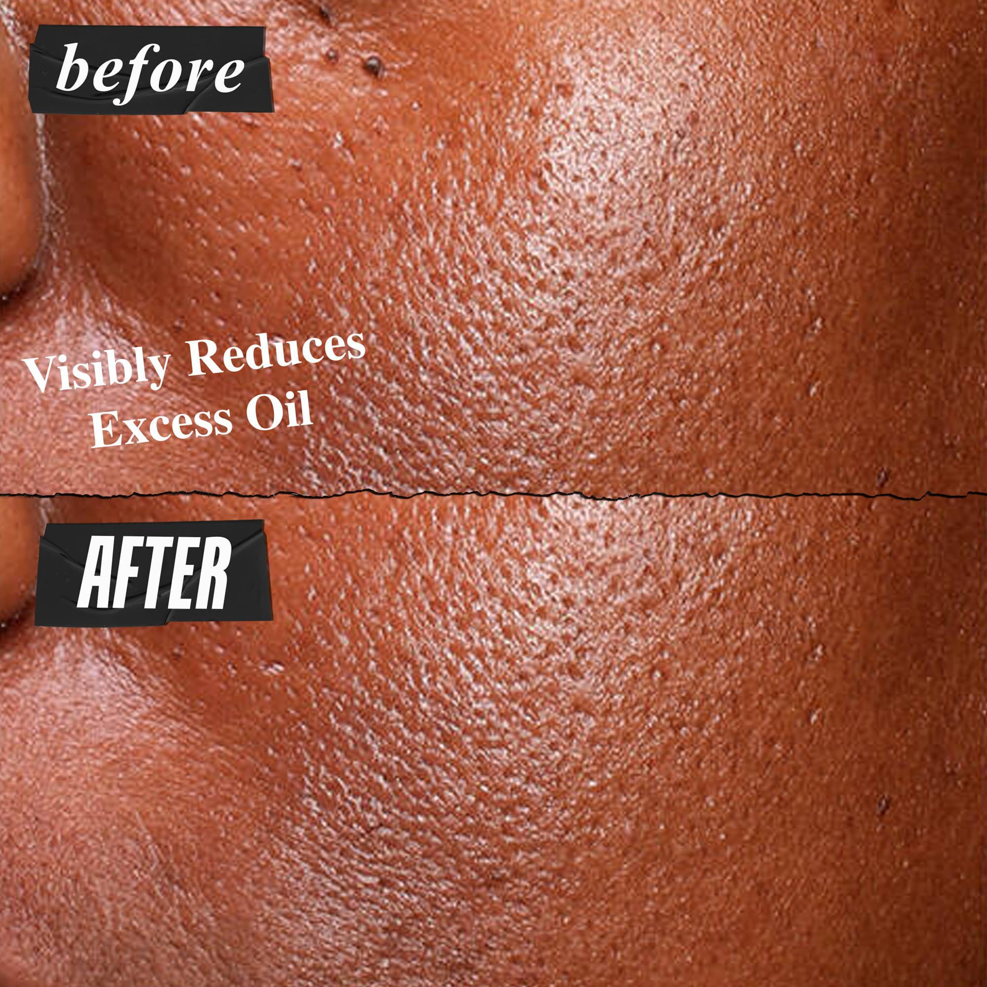 Voor- en na-foto van het Kiehl's Ultra Pure High-Potency Serum dat overtollig vet zichtbaar vermindert
