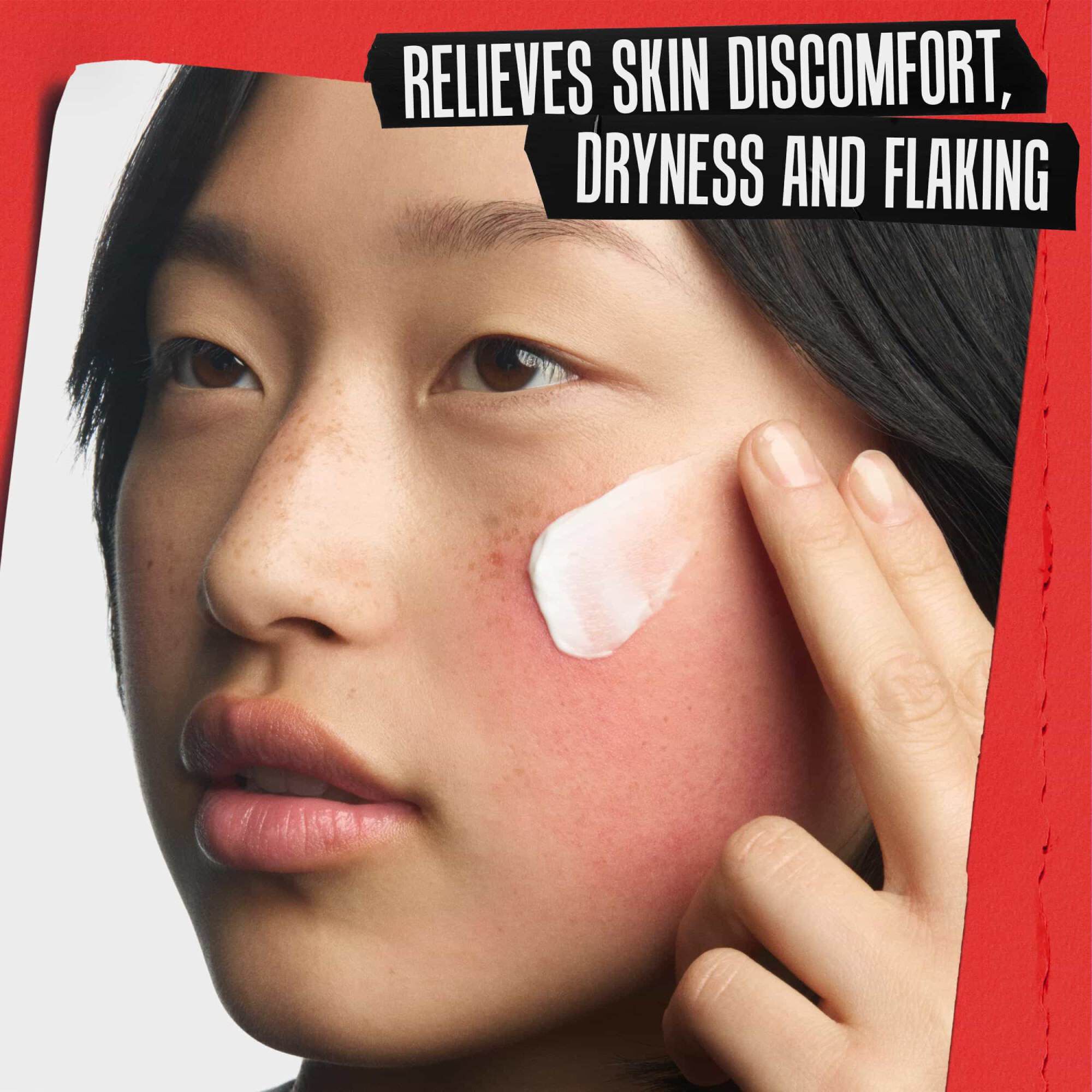 Close-up van de herstellende creme die op een geirriteerde wang wordt aangebracht. Tekst: VERZACHT ONGEMAK, DROOGHEID EN SCHILFERING VAN DE HUID.