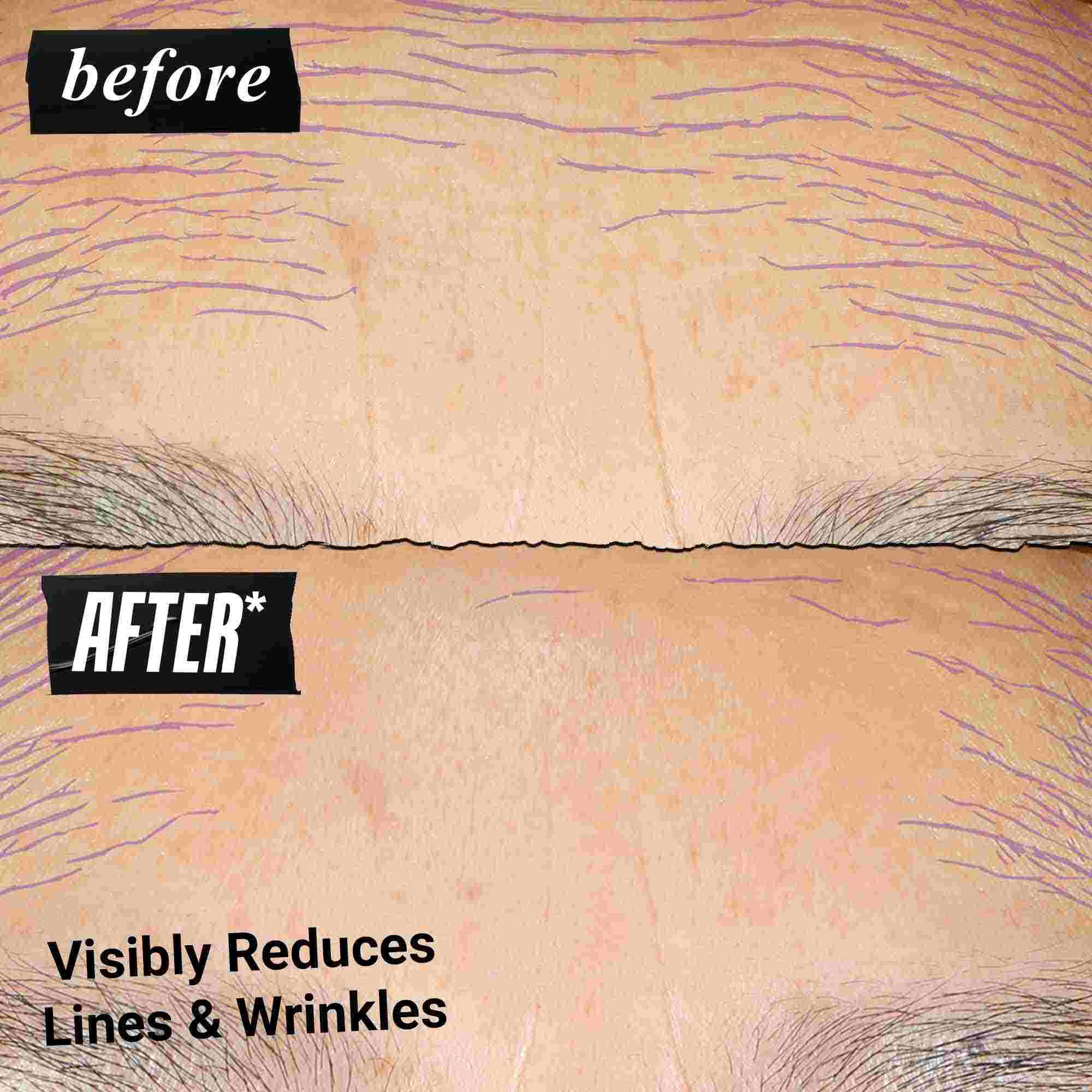 Photo Avant/Apres - Kiehl's Retinol Skin-Renewing Daily Micro-Dose aide a ameliorer le teint et le grain de peau