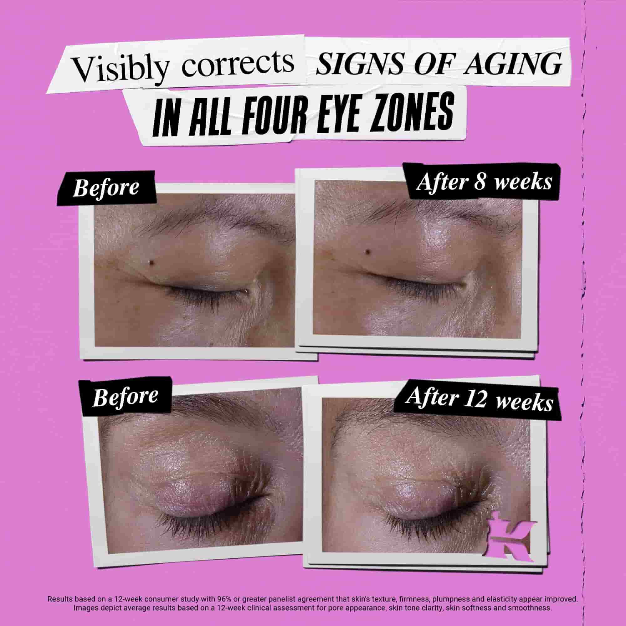 Photo Avant/Apres du Soin Yeux Zone Regard Super Multi-Corrective Kiehl's corrigeant les signes de l'age