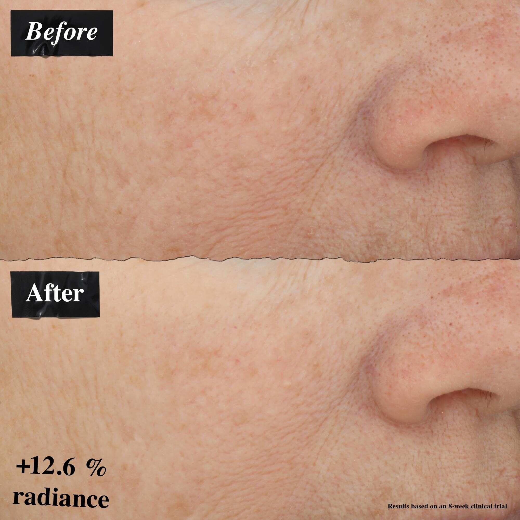 Een voor-en-na beeldvergelijking die verbetering in huidroodheid toont na gebruik van Powerful-Strength Line-Reducing Concentrate.