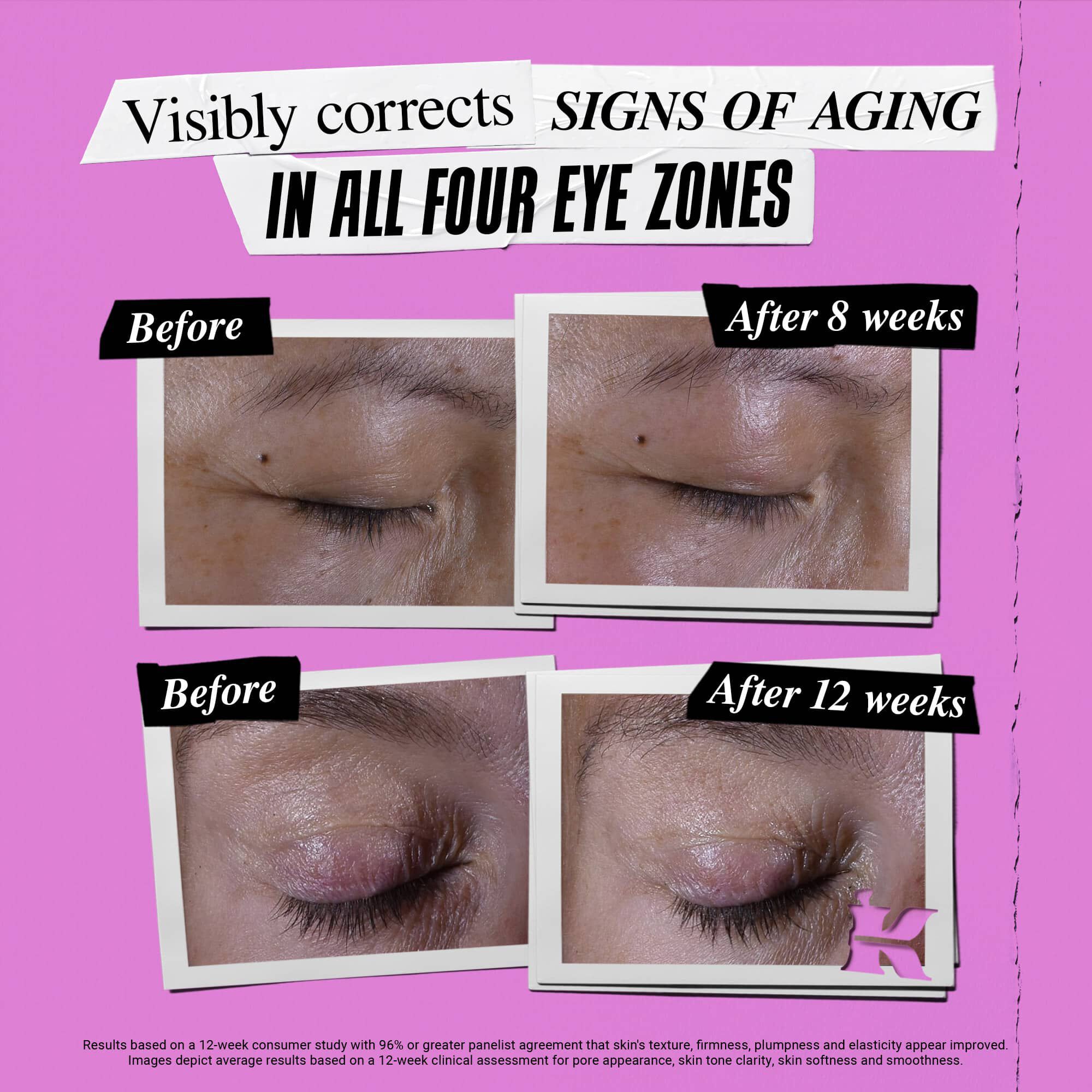 Photo Avant/Apres du Soin Yeux Zone Regard Super Multi-Corrective Kiehl's corrigeant les signes de l'age