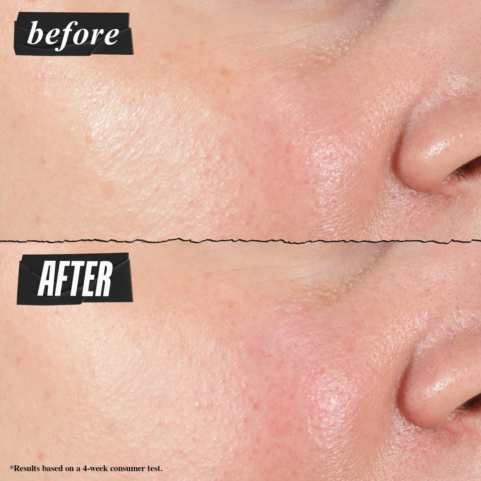 Voor- и na-foto - Kiehl's Hydro Plumping Serum Concentrate vermindert porien zichtbaar