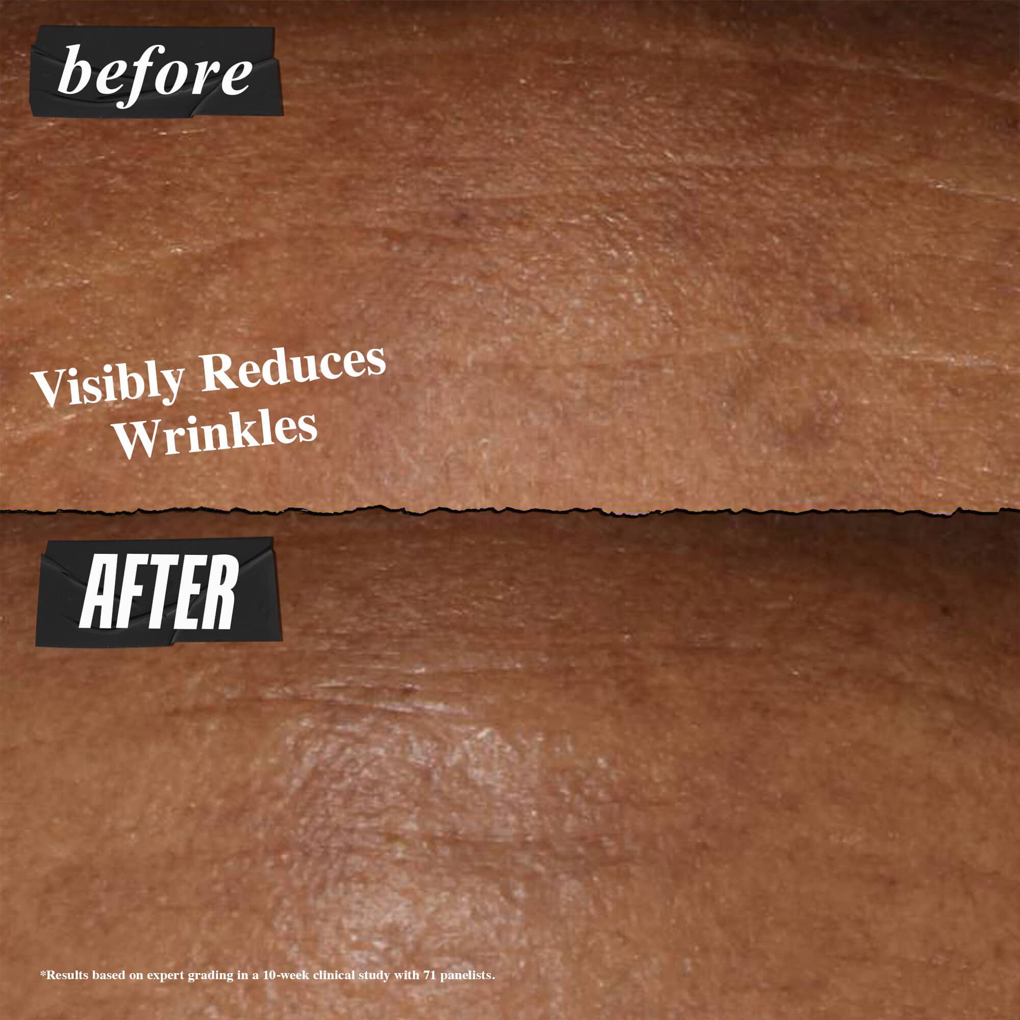Photo Avant/Apres - Le Serum de Nuit Retinol Fast Release de Kiehl's reduit visiblement les rides